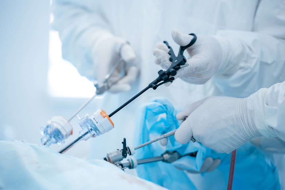 Nahaufnahme von Chirurgen, die mit Präzisionsinstrumenten eine laparoskopische Operation zur Entfernung von Nierensteinen durchführen.